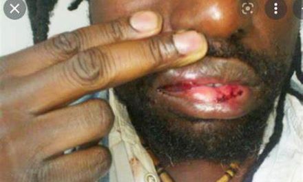 ZAPPING : Halte à l’encasernement des Droits de l’Homme au Gabon