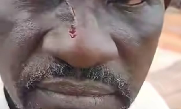 David MBERAKOUMA, sauvagement agressé par un débiteur !