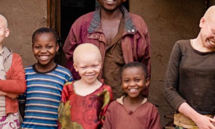La 7ème journée Internationale de sensibilisation à l albinisme, célébrée à Libreville